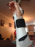 Wrist surgery